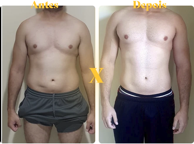 antes-x-depois-copiar-2-copiar-10.webp