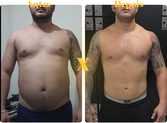antes-x-depois-copiar-2-copiar-11.webp