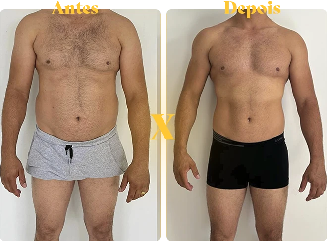 antes-x-depois-copiar-2-copiar-5.webp