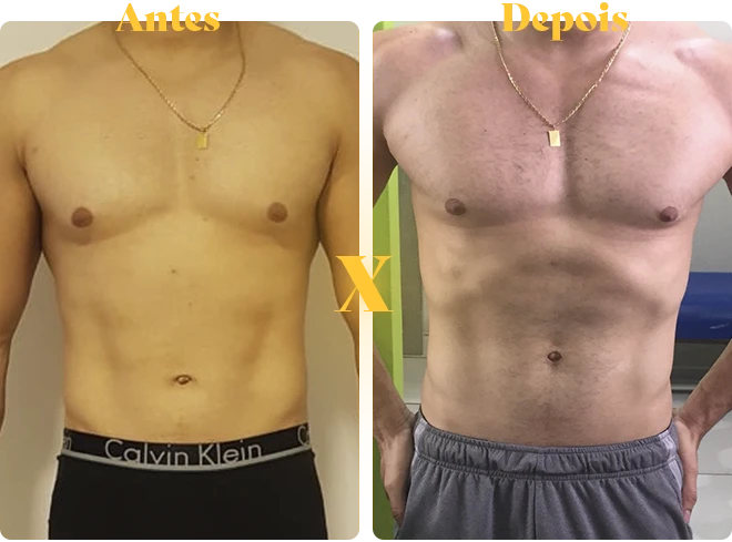 antes-x-depois-copiar-2-copiar-8.webp