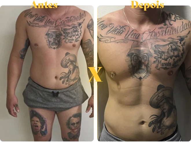 antes-x-depois-copiar-2-copiar-9.webp